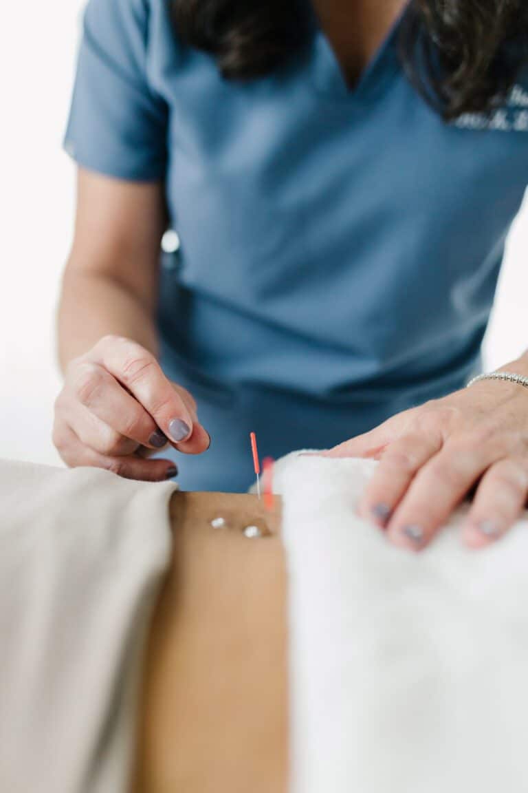 Needling Abdomen in Portland OR