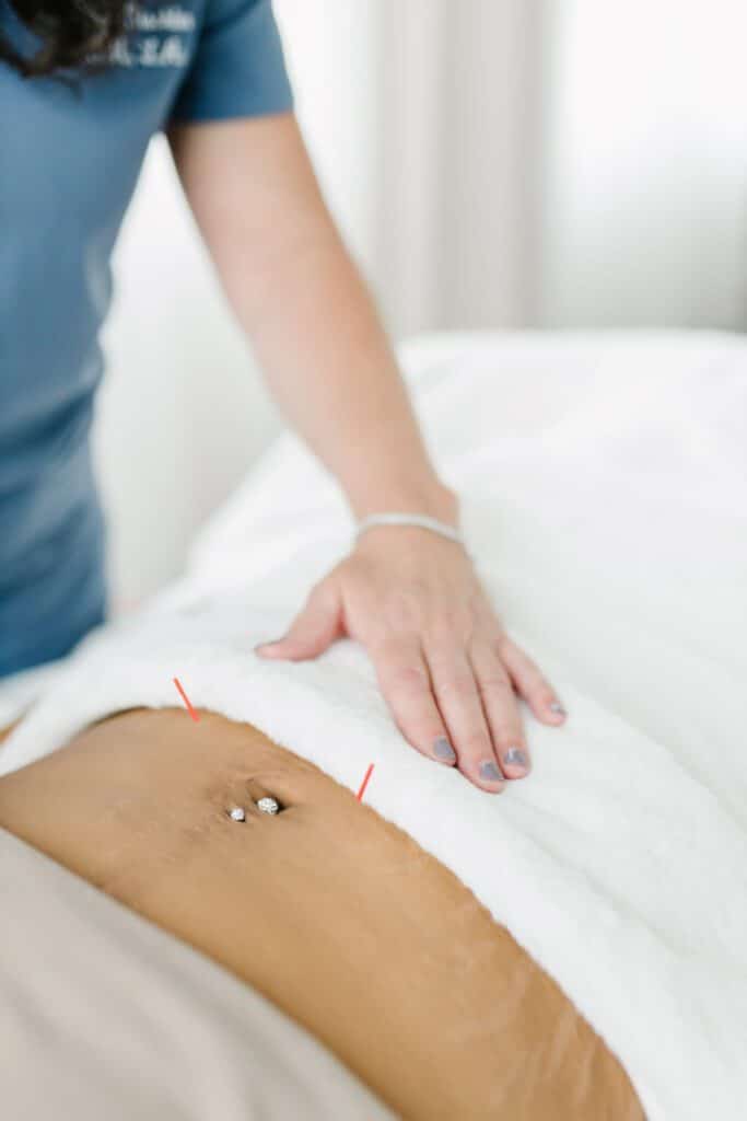 Pelvic floor acupuncture treatment on women's abdomen
