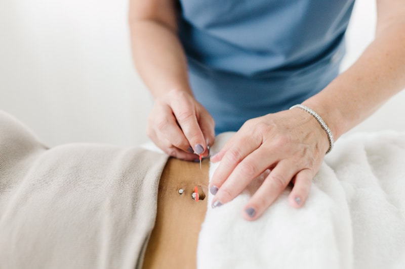 can acupuncture help with period pain? YES!