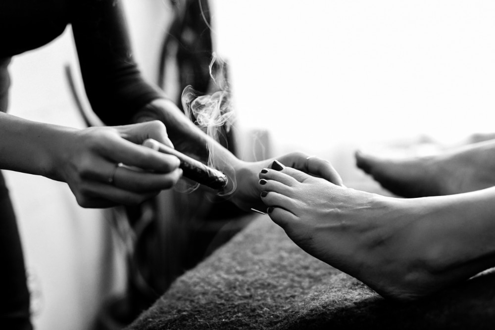 Moxibustion treatment applied to a patient’s foot during a session, part of holistic care often included in fertility success stories