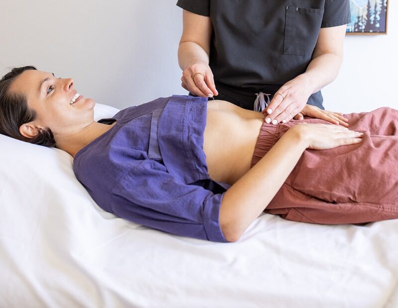 Acupuncturist placing needles in a patient’s abdomen during a fertility acupuncture session, highlighting personalized treatment for women preparing for embryo transfer at a Portland clinic.